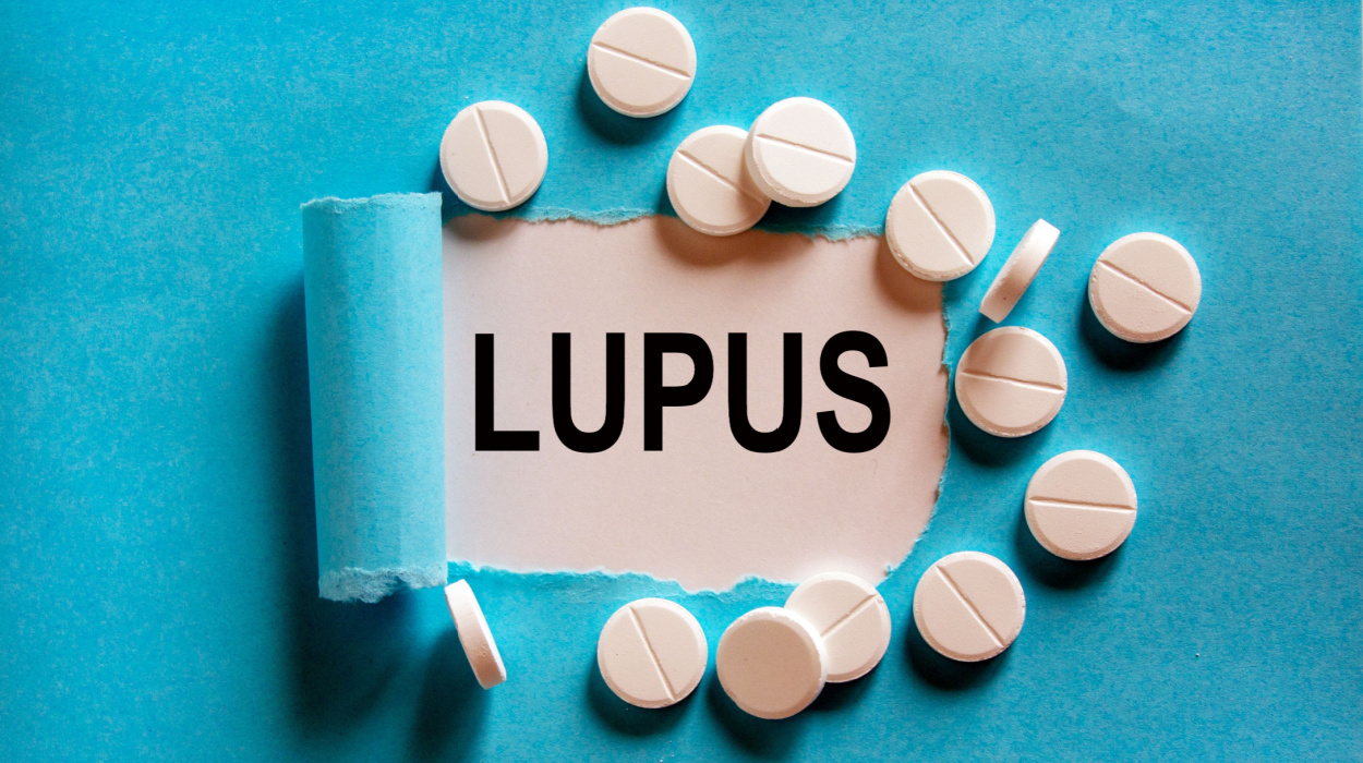 lupus statistics