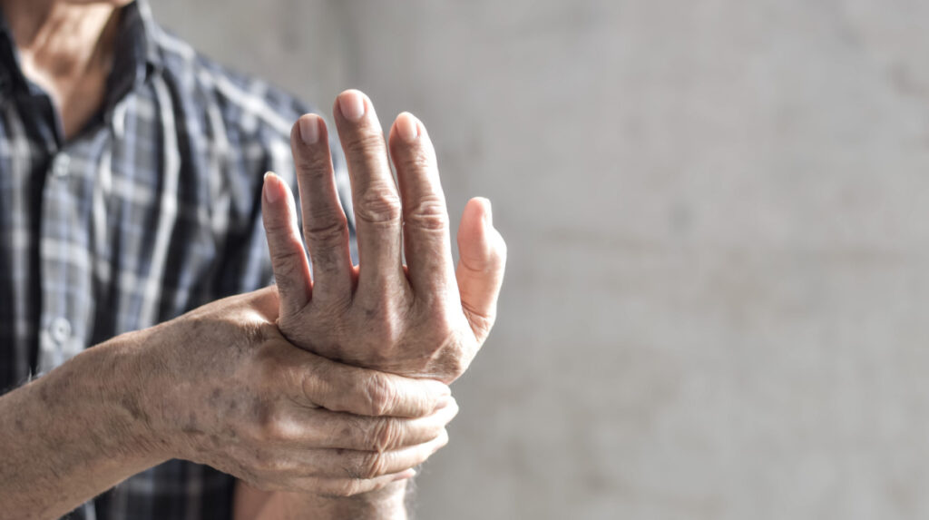rheumatoid arthritis statistics