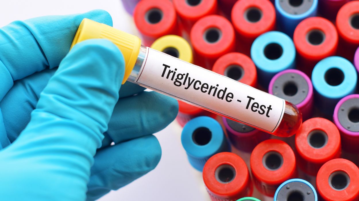 What Are Triglycerides